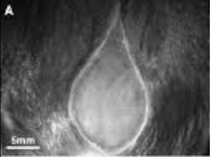 بروستاتا طبيعية — بعد الدعم